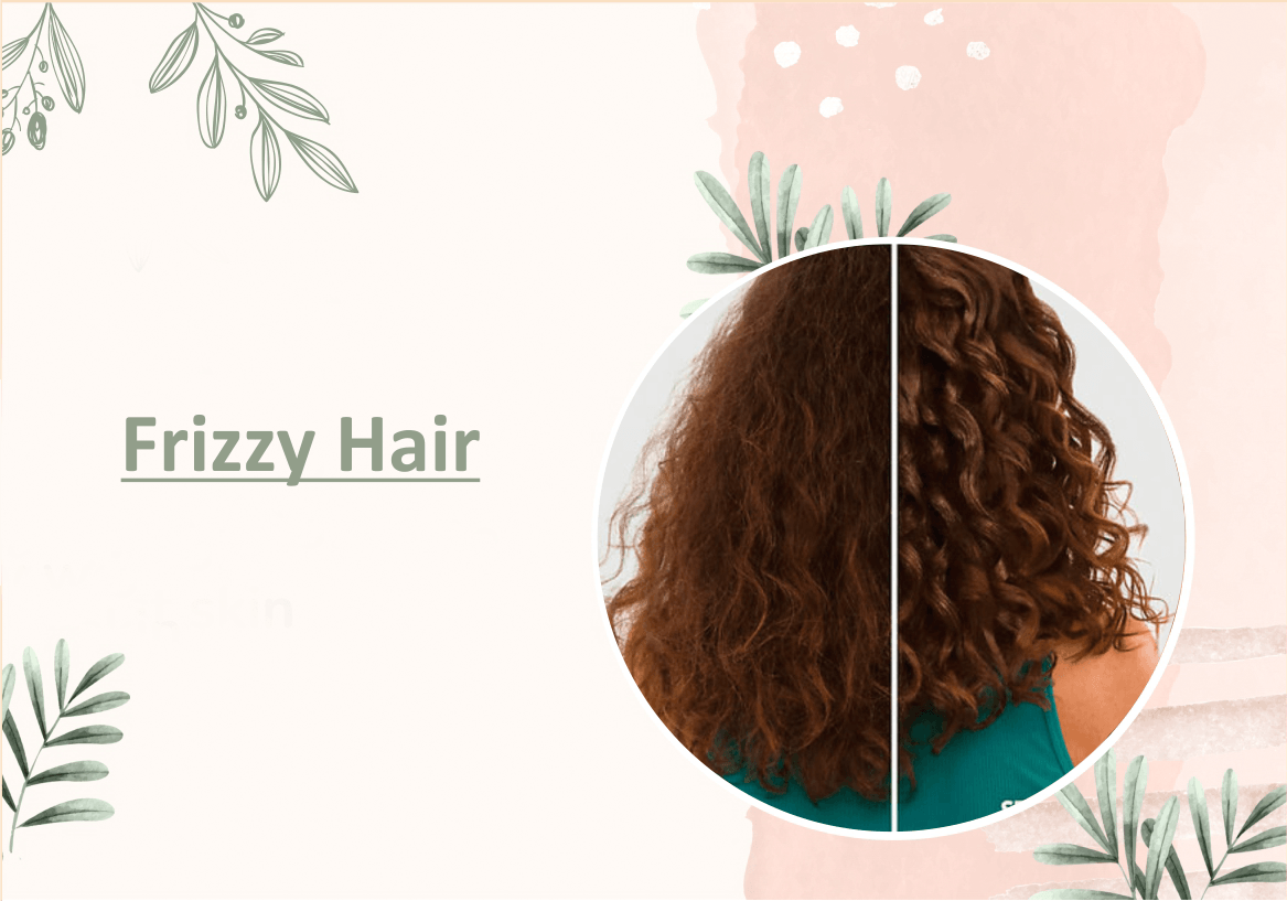Frizzy Hair - Myhi9