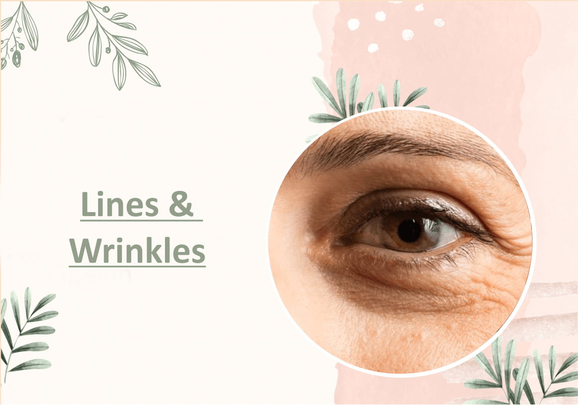 Line & Wrinkles - Myhi9