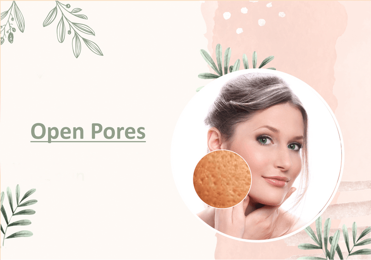 Open Pores - Myhi9