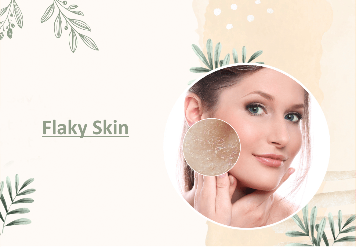 Flaky Skin - Myhi9