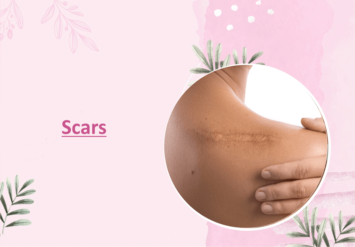 Scars - Myhi9