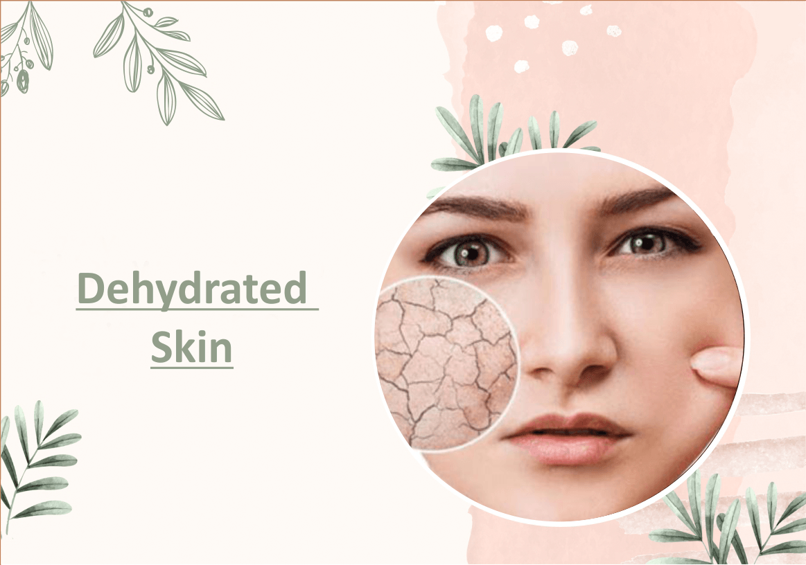 Dehydrated Skin - Myhi9